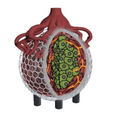 De novo design of a tumor spheroid containing multiple cell types within a 3D printed scaffold or "cage" with vascularisation 