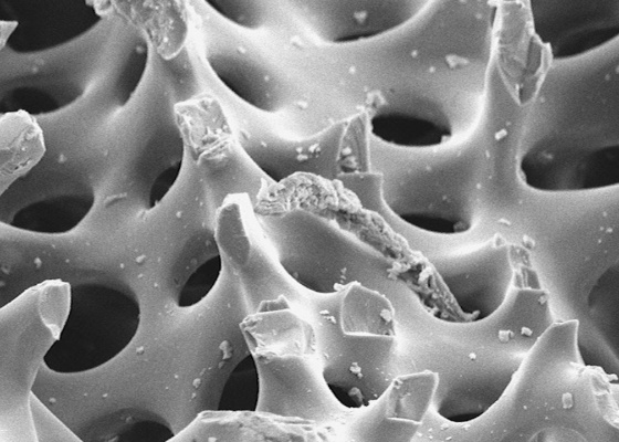 Preview imageSpine of a sea urchin in the SEM